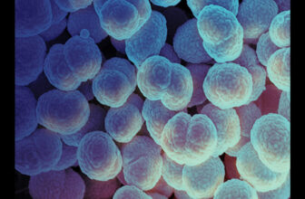 Alaskan Girl’s Dying From Gonorrhea Sparks Fears of a New Pressure